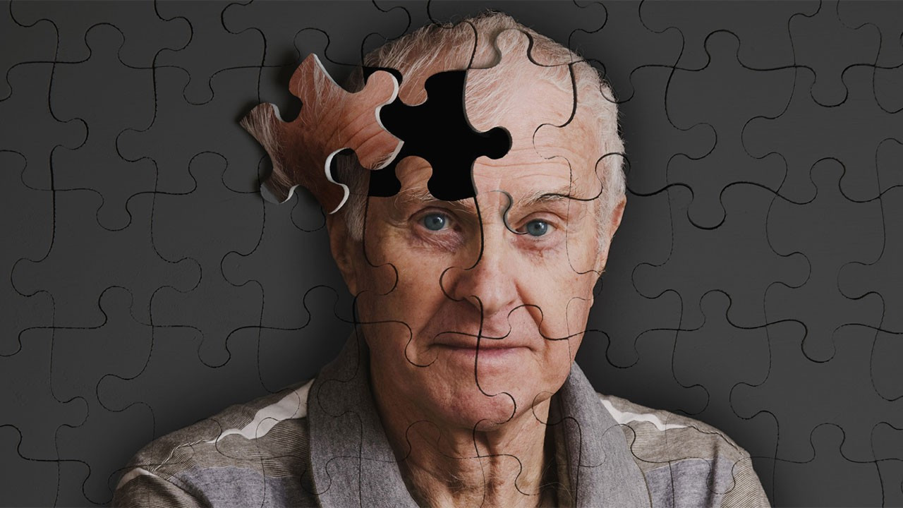 Bilim dünyasından sevindiren keşif: Belki de Alzheimer’ın nedeni bulundu