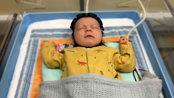 Doğumda beyin hasarını tespit eden başlık geliştirildi