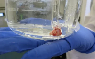 Bu minik beyin parçası, Alzheimer tedavisinde ilk adım olabilir mi?