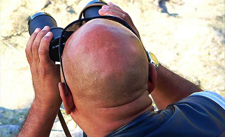 Yeni kellik ilacı ümit verdi: Yüzde 539 oranında saç artışı