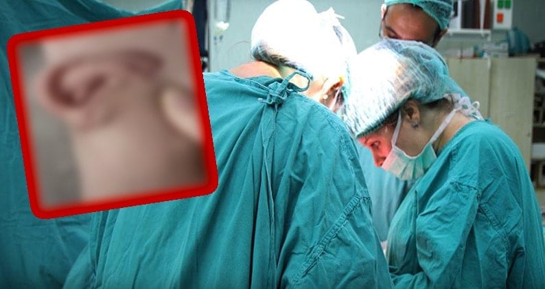 Yerine dikilecek kulağını beş ay ayağında taşıdı