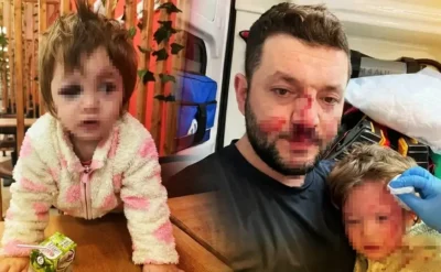 Odunla 14 aylık bebeğe saldırmak