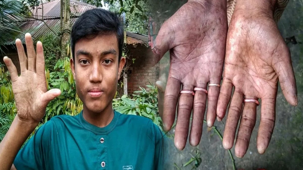 Hayret verici bir şey: Bu ailenin parmak izi yok!