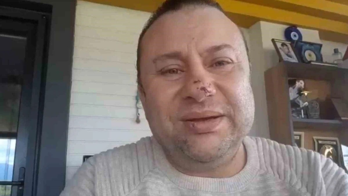 Önce pitbull saldırdı, sonra da et yiyen bakteri