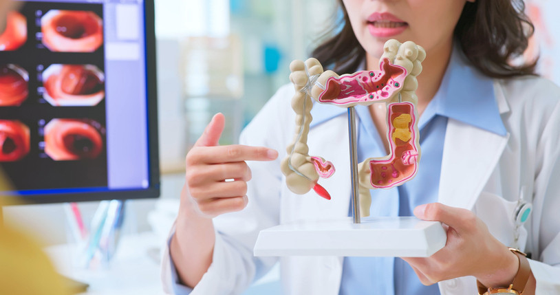 Gençlerde bağırsak kanseri neden artıyor: Dört büyük riske dikkat