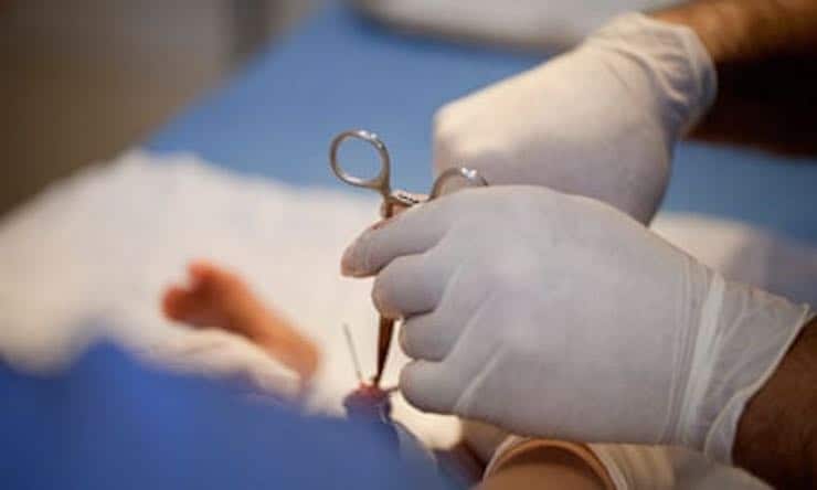 Belçika ile ABD arasında ‘sünnetçi’ krizi: ‘Utanç verici leke’