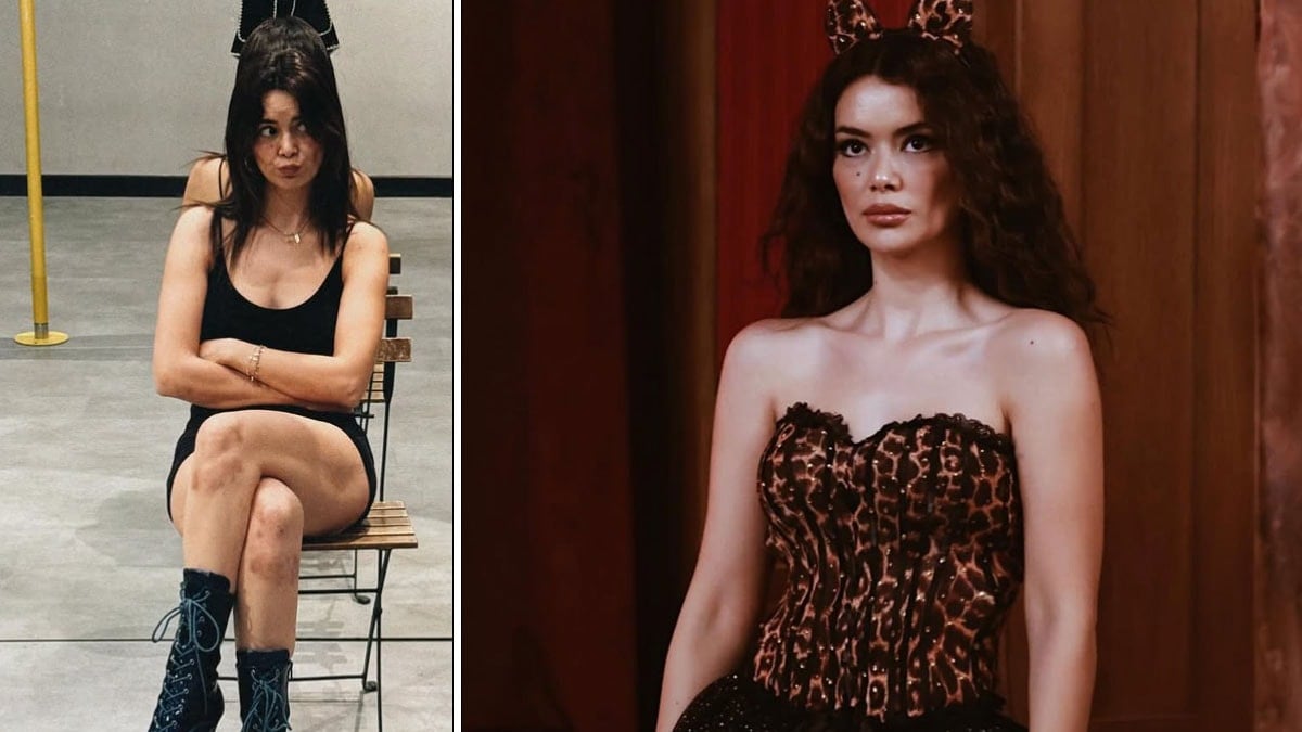 Seray Kaya, direk dansı yaparken dizlerini morarttı