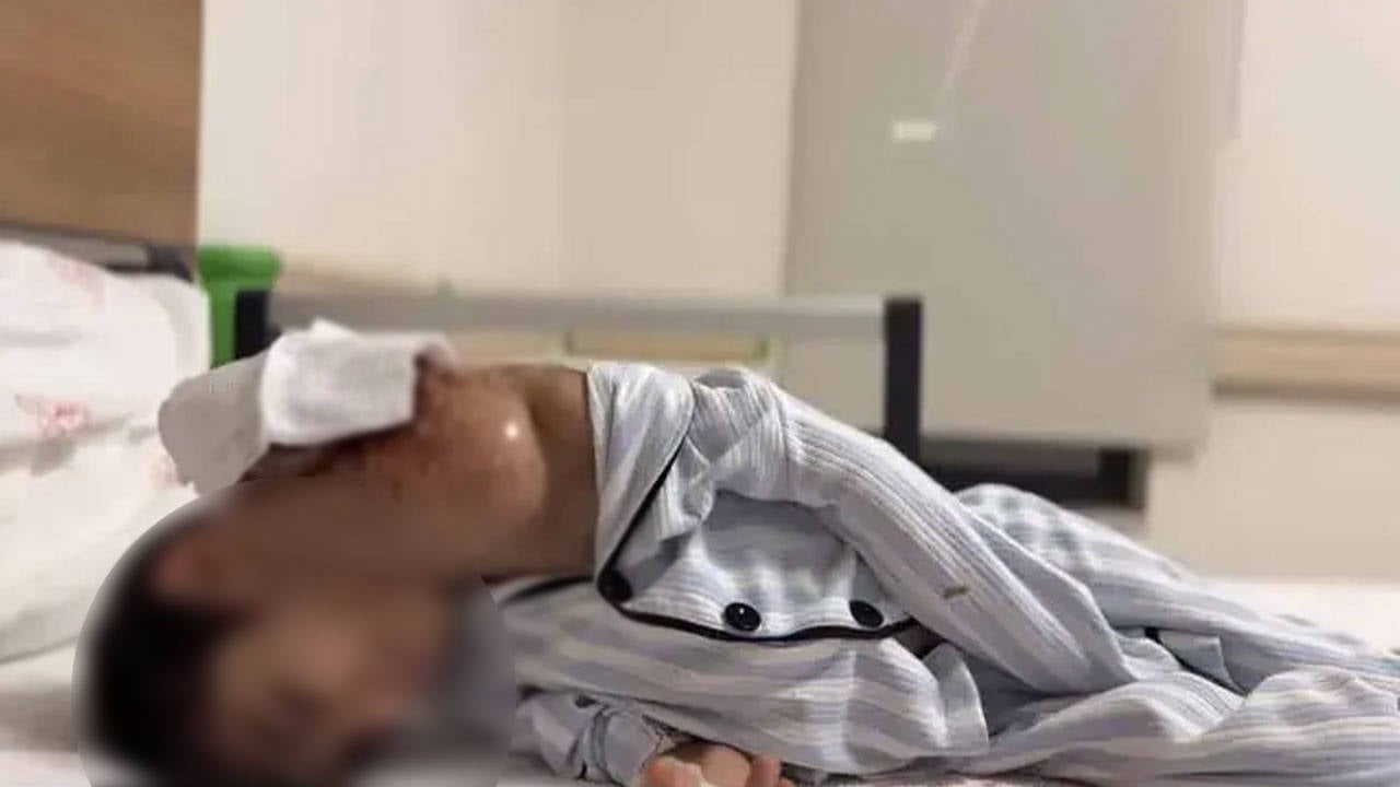 Sekiz yaşındaki çocuğun boynundan 3 kiloluk tümör çıkarıldı: Literatüre girdi