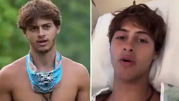 Survivor kâbusu: Yarışmacı gencin bacağı kesildi