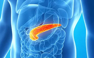 Pankreas kanserinde büyük umut: Kras proteini alt edildi