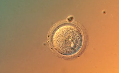 Bilimsel ilerleme mi, dehşetin geri dönüşü mü? İlk kez insan embriyosunda genetik düzeltme başarıldı