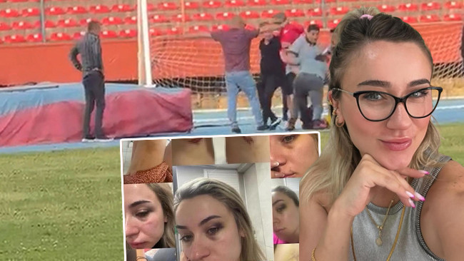 Elif öğretmen ‘Şiddet görüyorum’ dedi, ağabeyi gidip eski eşini dövdü
