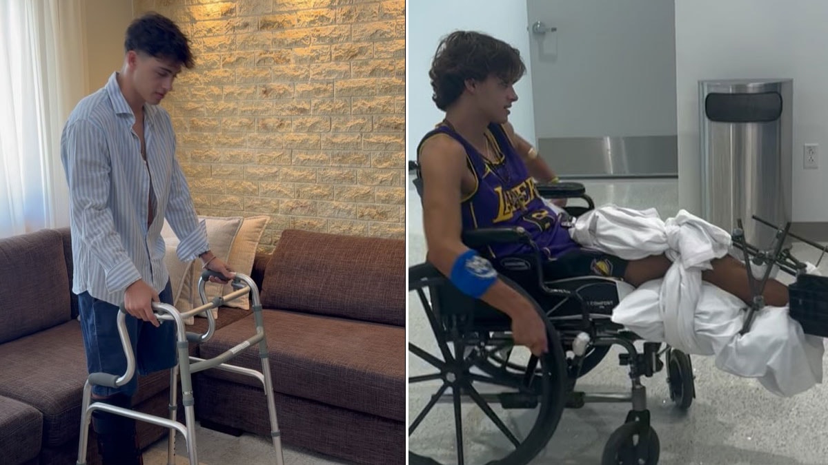 Survivor’da bacağını kaybetmişti: Yürütece başladı