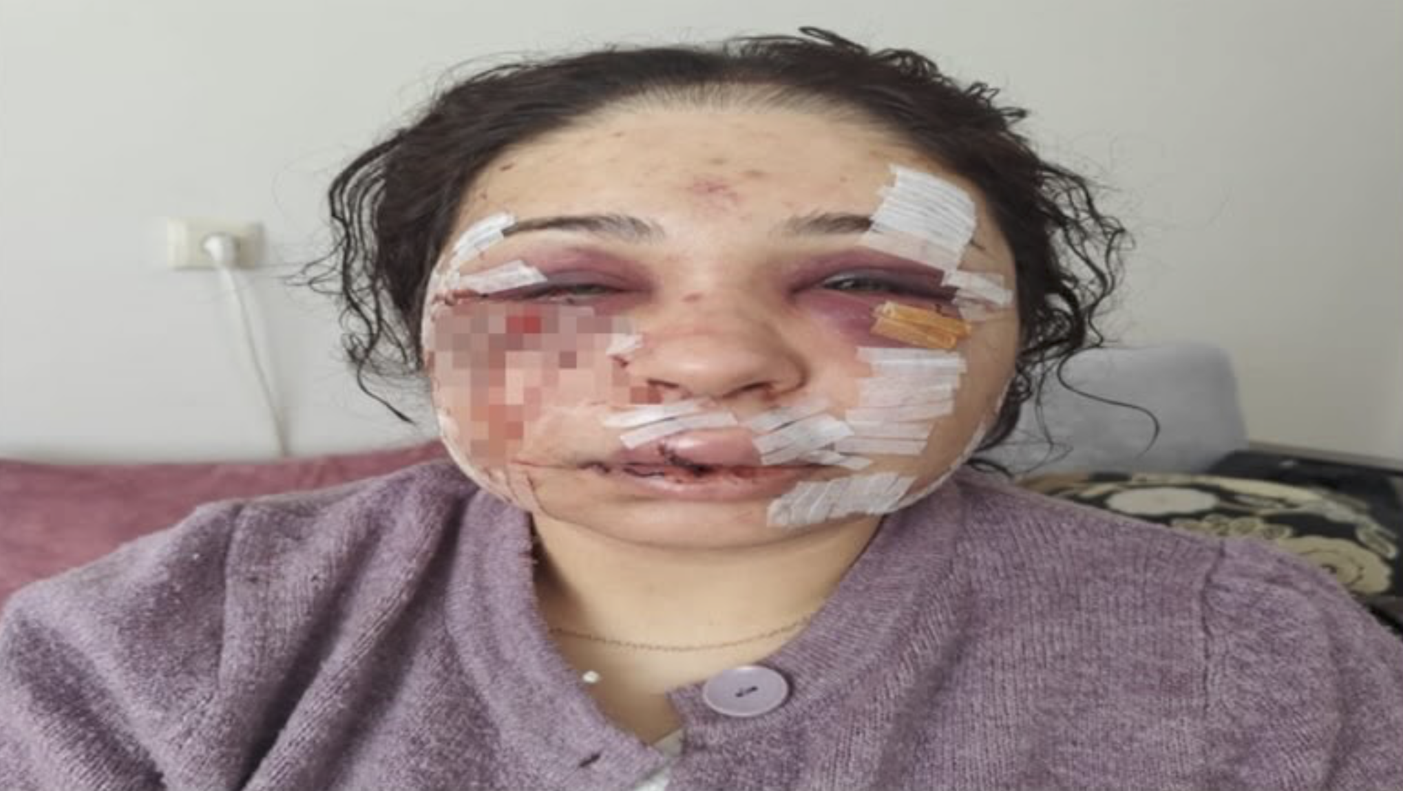 Yüzünde 60 dikiş olan kadına ceza!