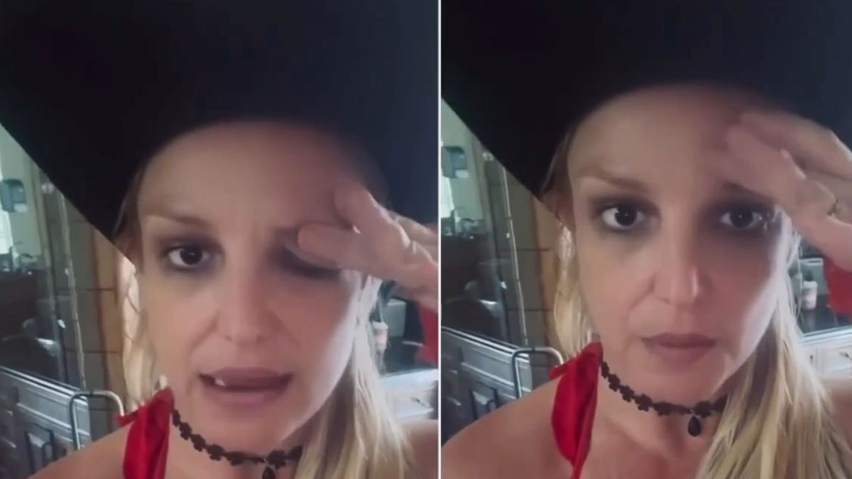 Britney Spears’ın estetik kâbusu: Gözü haftalarca düşük kaldı