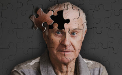 Alzheimer devrimi: Hastalığı 7 yıl önce teşhis etmenin bir yolu bulundu