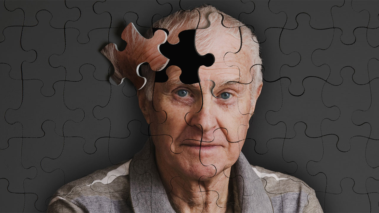 Alzheimer Hastalığı 7 Yıl Önce Teşhis Edilebilecek