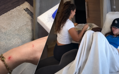 Survivor şampiyonunun şanssızlığı: Duşakabin yüzüne patladı